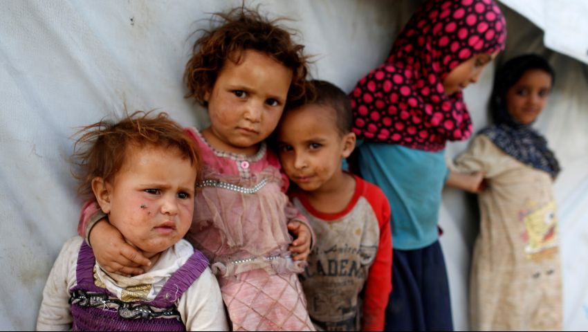 وكالات أممية تحذر من وفاة 400 ألف طفلاً يمنياً من الجوع